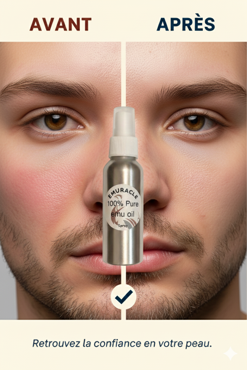 Emuracle. Notre spray 100 ml contient une huile d'émeu 100 % pure, triple raffinée et non grasse, issue des meilleurs élevages australiens