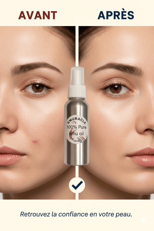 Emuracle. Notre spray 100 ml contient une huile d'émeu 100 % pure, triple raffinée et non grasse, issue des meilleurs élevages australiens - Emuracle